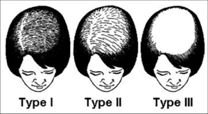 balding