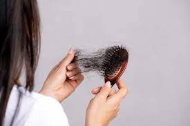 hair-loss