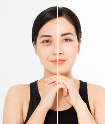 plastic surgery