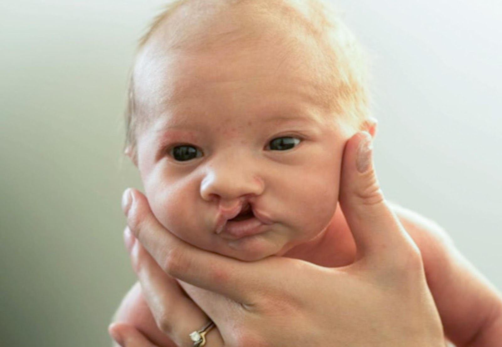 Congenital Anomalies