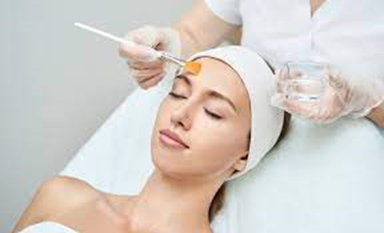 chemical peels